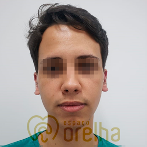 3_Depois