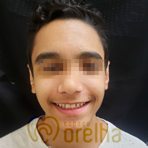 6_Depois